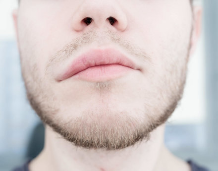 Störung Gesichts- und Mundmuskulatur